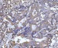 Anti-Beclin 1 Antibody Picoband™ (monoclonal, 2D12A3)
